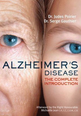 bokomslag Alzheimer's Disease: The Complete Introduction