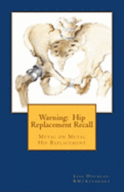 bokomslag Warning: Hip Replacement Recall: Warning: Hip Replacement Recall Metal on Metal Devices