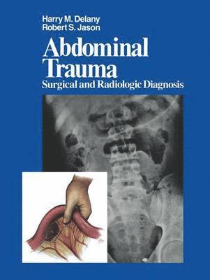 Abdominal Trauma 1