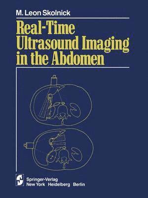 bokomslag Real-time Ultrasound Imaging in the Abdomen