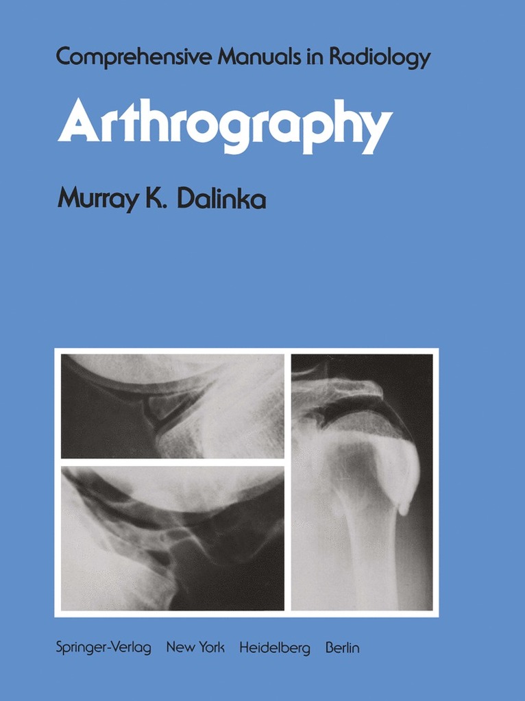 M. K. Dalinka, M. K. Dalinka - Arthrography, Häftad