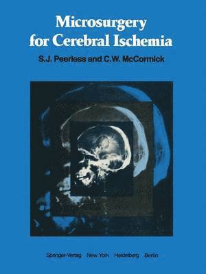 Microsurgery for Cerebral Ischemia 1