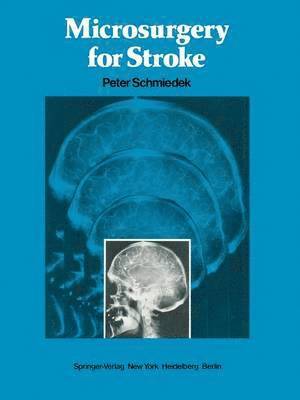 bokomslag Microsurgery for Stroke