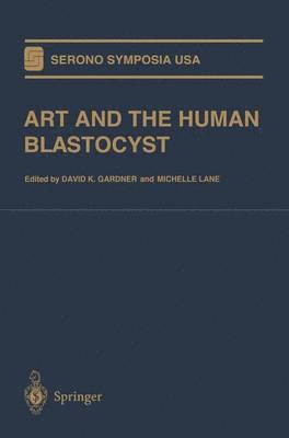 David K. Gardner, Michelle Lane - ART and the Human Blastocyst, Häftad