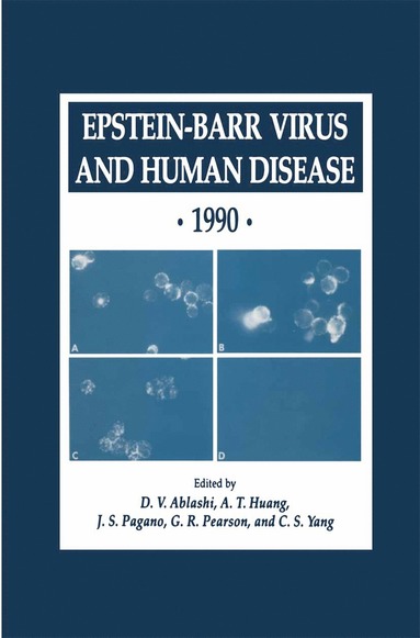 bokomslag Epstein-Barr Virus and Human Disease · 1990