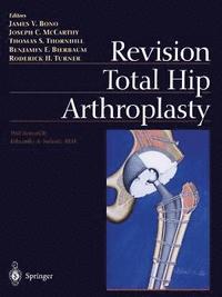 bokomslag Revision Total Hip Arthroplasty