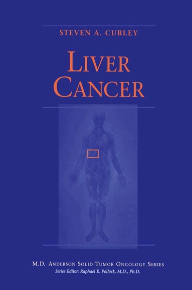 Steven A. Curley - Liver Cancer, Häftad