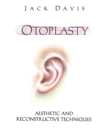 bokomslag Otoplasty