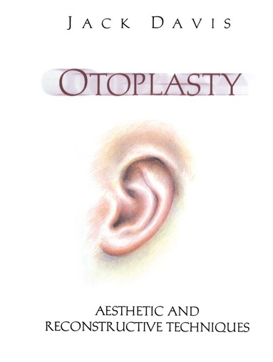 bokomslag Otoplasty