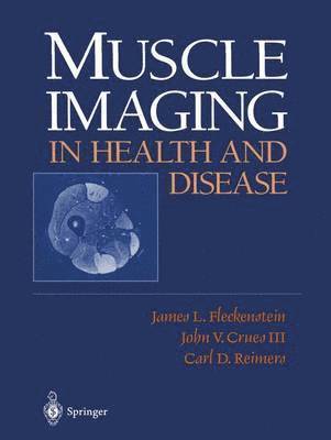 Muscle Imaging in Health and Disease 1