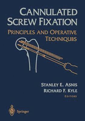 Cannulated Screw Fixation 1