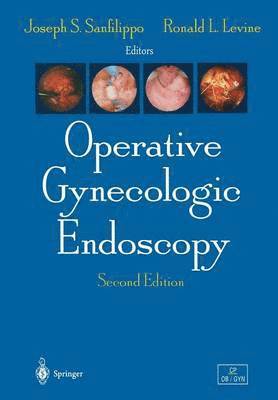 Operative Gynecologic Endoscopy 1