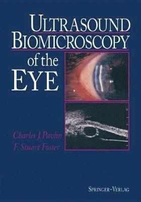 Ultrasound Biomicroscopy of the Eye 1