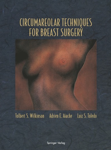 bokomslag Circumareolar Techniques for Breast Surgery