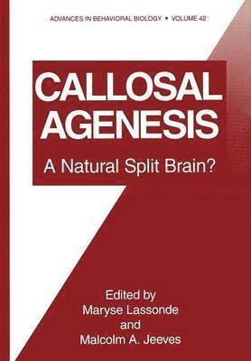 Callosal Agenesis 1
