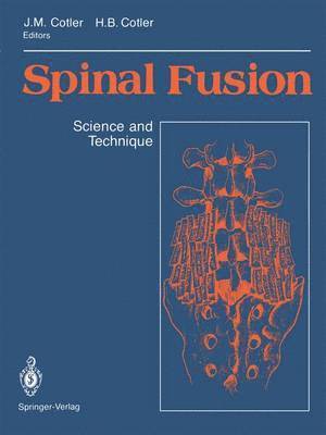 bokomslag Spinal Fusion
