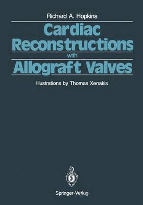 Cardiac Reconstructions with Allograft Valves 1