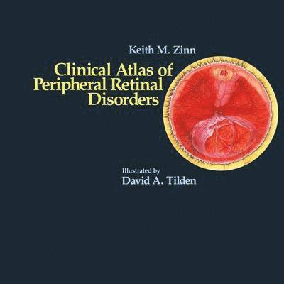 Clinical Atlas of Peripheral Retinal Disorders 1