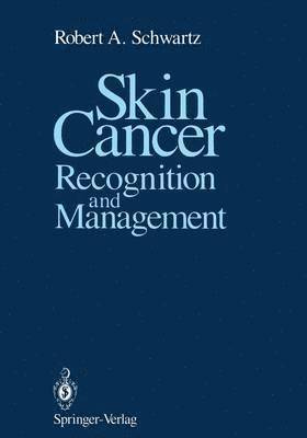 Skin Cancer 1