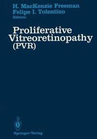 bokomslag Proliferative Vitreoretinopathy (PVR)