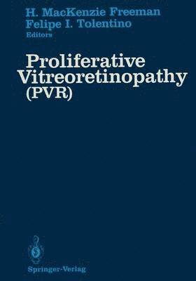 Proliferative Vitreoretinopathy (PVR) 1
