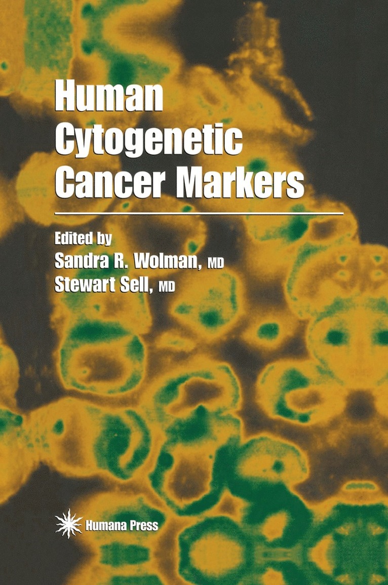 Sandra R. Wolman, Stewart Sell - Human Cytogenetic Cancer Markers, Häftad