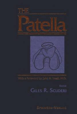 The Patella 1
