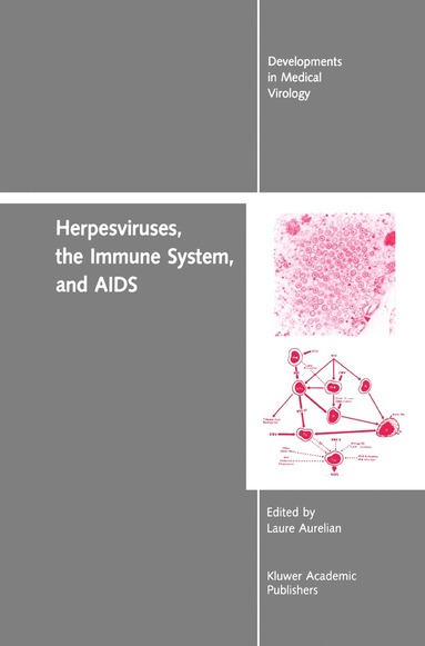 bokomslag Herpesviruses, the Immune System, and AIDS