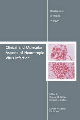 Clinical and Molecular Aspects of Neurotropic Virus Infection 1