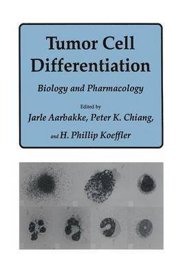 Tumor Cell Differentiation 1
