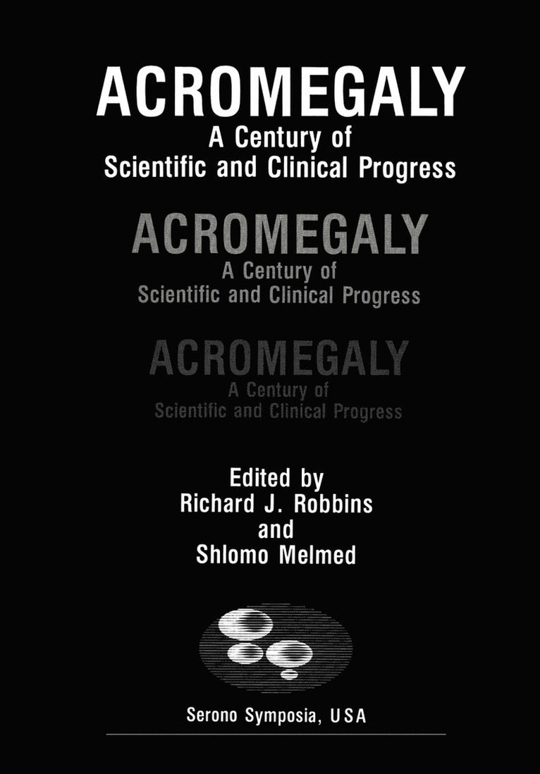 Acromegaly 1