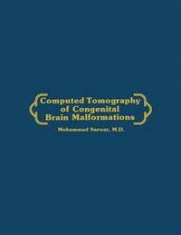 bokomslag Computed Tomography of Congenital Brain Malformations