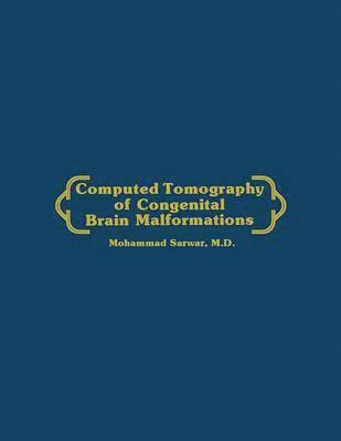 bokomslag Computed Tomography of Congenital Brain Malformations