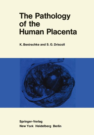KURT BENIRSCHKE - Pathology of the Human Placenta, Häftad