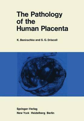 KURT BENIRSCHKE, Kurt Benirschke - Pathology of the Human Placenta, Häftad
