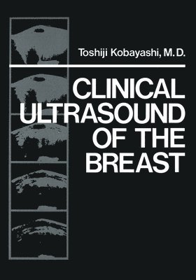 Clinical Ultrasound of the Breast 1