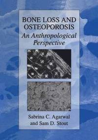 bokomslag Bone Loss and Osteoporosis