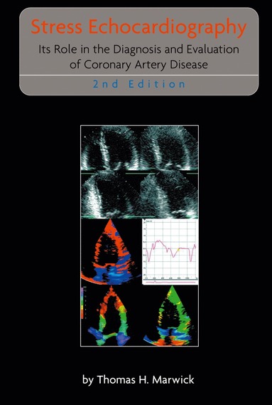 bokomslag Stress Echocardiography