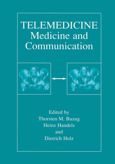 Thorsten M. Buzug, Heinz Handels, Dietrich Holz - Telemedicine, Häftad