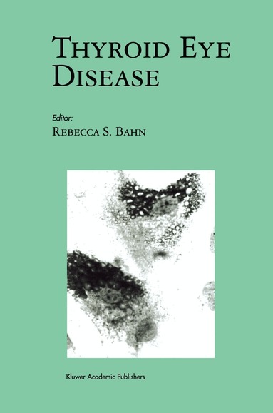 Rebecca S. Bahn - Thyroid Eye Disease, Häftad