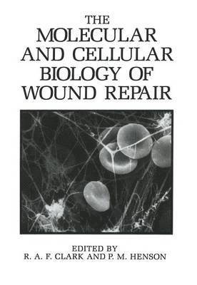 The Molecular and Cellular Biology of Wound Repair 1