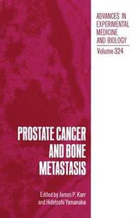 bokomslag Prostate Cancer and Bone Metastasis