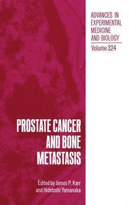 James P. Karr, Hidetoshi Yamanaka - Prostate Cancer and Bone Metastasis, Häftad