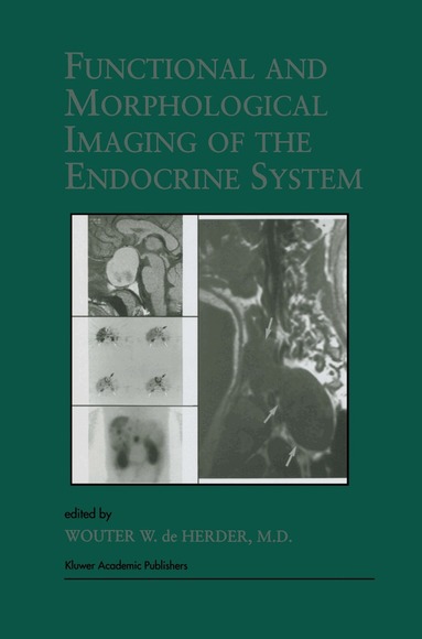 W.W. de Herder - Functional and Morphological Imaging of the Endocrine System, Häftad