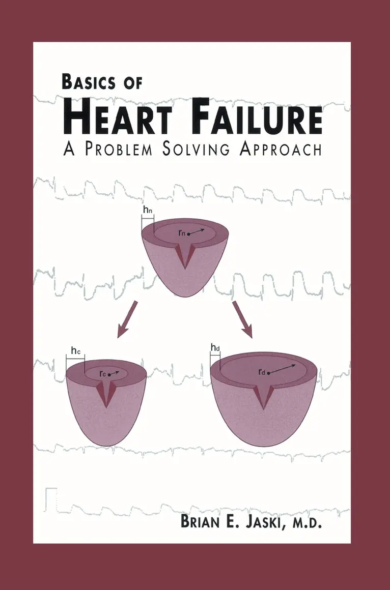 Brian E. Jaski - Basics of Heart Failure, Häftad. Tillgänglighet: Lägg i varukorg