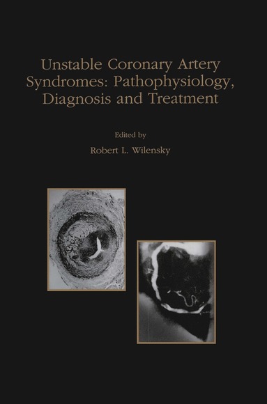 bokomslag Unstable Coronary Artery Syndromes Pathophysiology, Diagnosis and Treatment