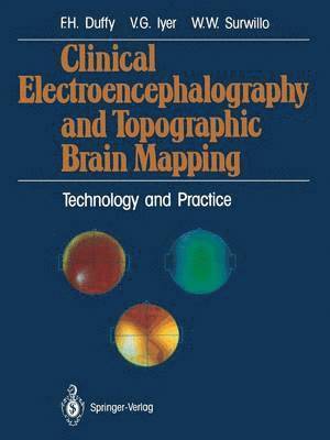 Clinical Electroencephalography and Topographic Brain Mapping 1