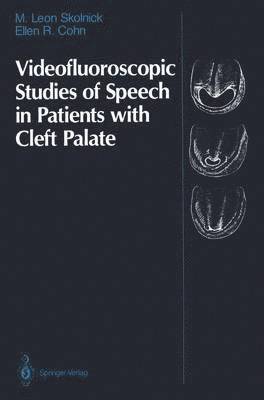 bokomslag Videofluoroscopic Studies of Speech in Patients with Cleft Palate