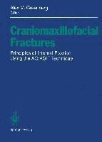 bokomslag Craniomaxillofacial Fractures