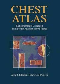 bokomslag Chest Atlas